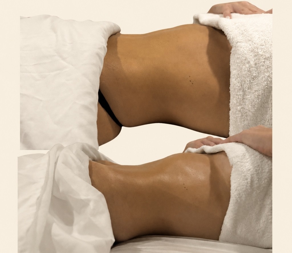 Gentle lymphatic drainage massage on a client at The Beauty Rezort