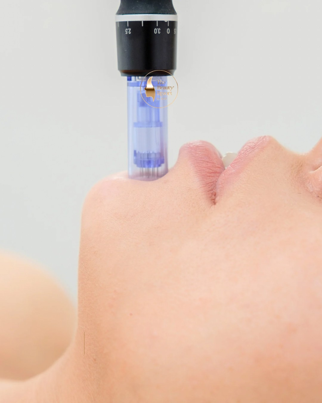 Microneedling pen treating a client's cheek at The Beauty Rezort